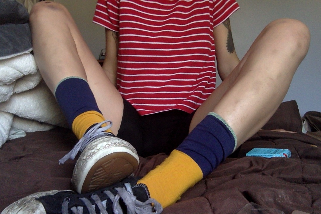succuletus:  aesthetic: post-80s dodgeball montage bruises 