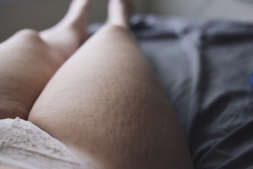 Trying my best to learn how to love each little stretch mark that appears on my thighs.