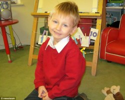 congenitaldisease:  4-year-old Daniel Pelka died from months of torture and abuse at the hands of his mother, Magdalena Łuczak, and her boyfriend, Mariusz Krężołek, on 3 March, 2012. When Daniel was discovered, he was described as resembling a “famine