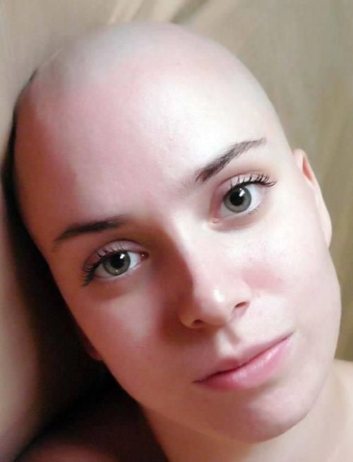 blogdocareca:Outra carequinha lindinha