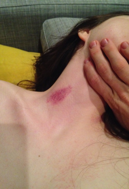 redstil3ttos: her-body-never-lies:  Well L has successfully brutalized me.   ❣◕ ‿ ◕❣