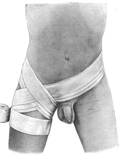 agracier:  illustrations from an early 20th German medical textbook on the proper methods of bandaging …