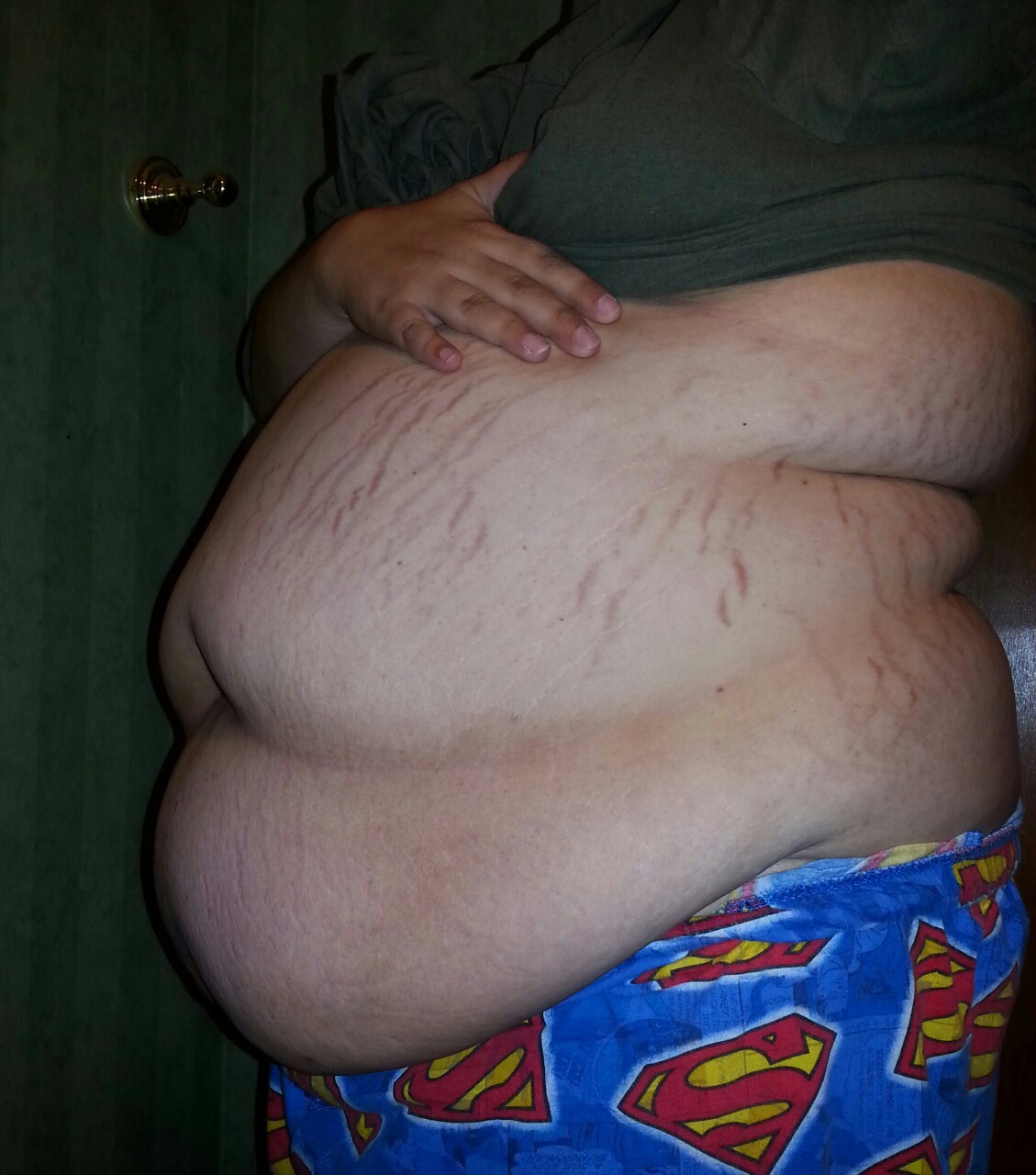 obesegoddess:  Bored belly