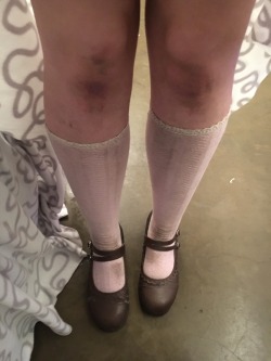 pervy-doll:  Aftermath picture - got thrown