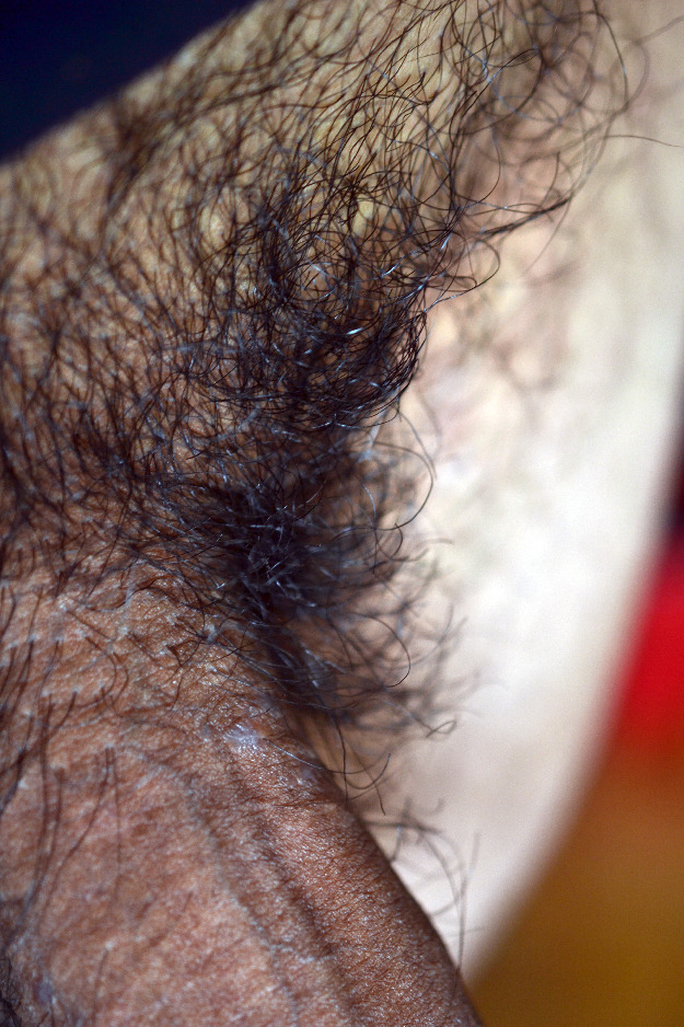 Beardburnme