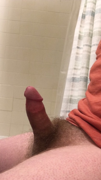 cutguy87: conqueredcocks:  My Cock, after the american medical system decided i needed a trim and a 