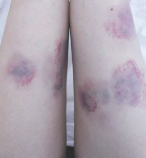 petitexbabydoll:  thighs dump part. 3