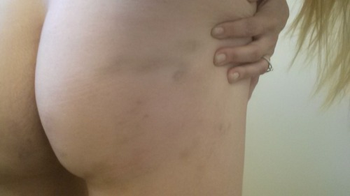 squirtingprincess69:  Heres some of them. I need help taking more cause some of the bruises are by my pussy and in between my cheeks.  Can you say beat the pussy up?