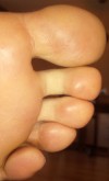 Sex feet-toes-soles-86-deactivated2:Close up pictures