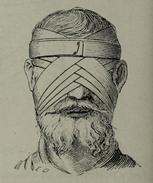 nemfrog:Face bandages. Nouveaux éléments de petite chirurgie.1903. 