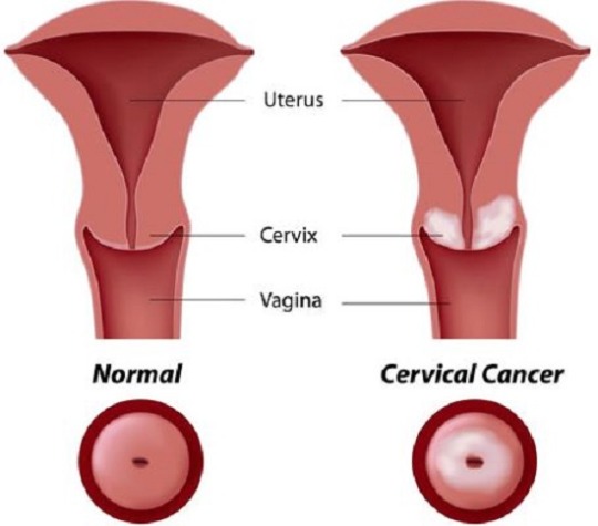 Female reproductive system anatomy and vagina