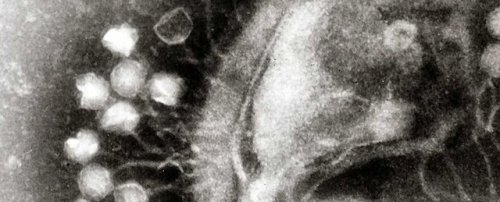 A Century-old Discovery Of A Virus Could Become Our Solution To Antibiotic Resistance 