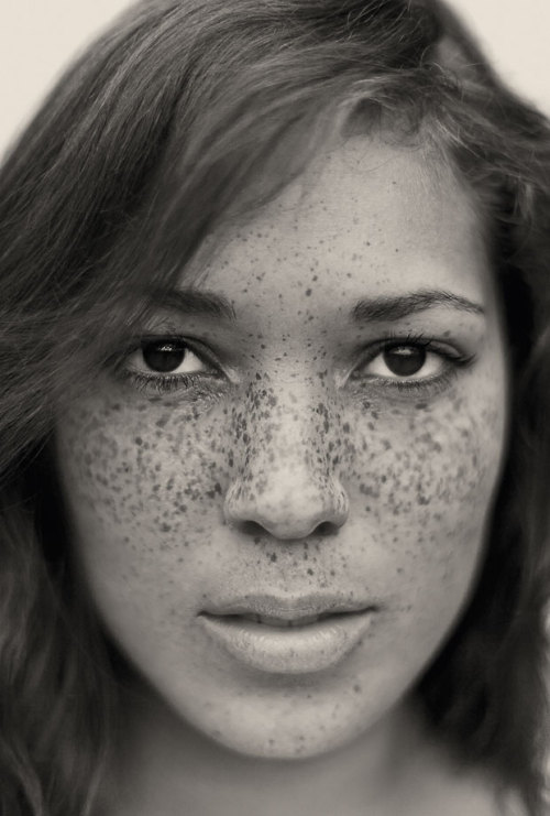 s0mmerspr0ssen:   For his recently published picture book Freckles (Splice Pictures Publishing), the Swiss photographer Reto Caduff has taken pictures of freckled women all over Europe. His pictures prove: freckles are beautiful. Don’t hide yourself