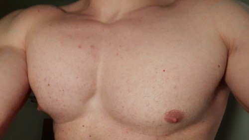Side Effects: Gyno & Lactation