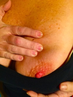 mcmjbp:  A little nipple for you!  Love