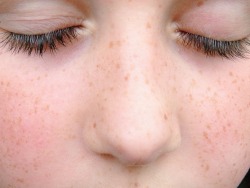 fleureh:  My cousins freckles are so so pretty