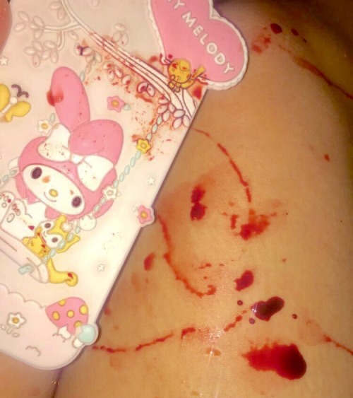 noplacelikehome99:nosebleed ft my melody