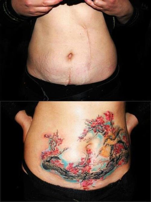 tattoo-queens:  skindeeptales:  Amazing scar covering tattoos  Tattoos can be for healing 