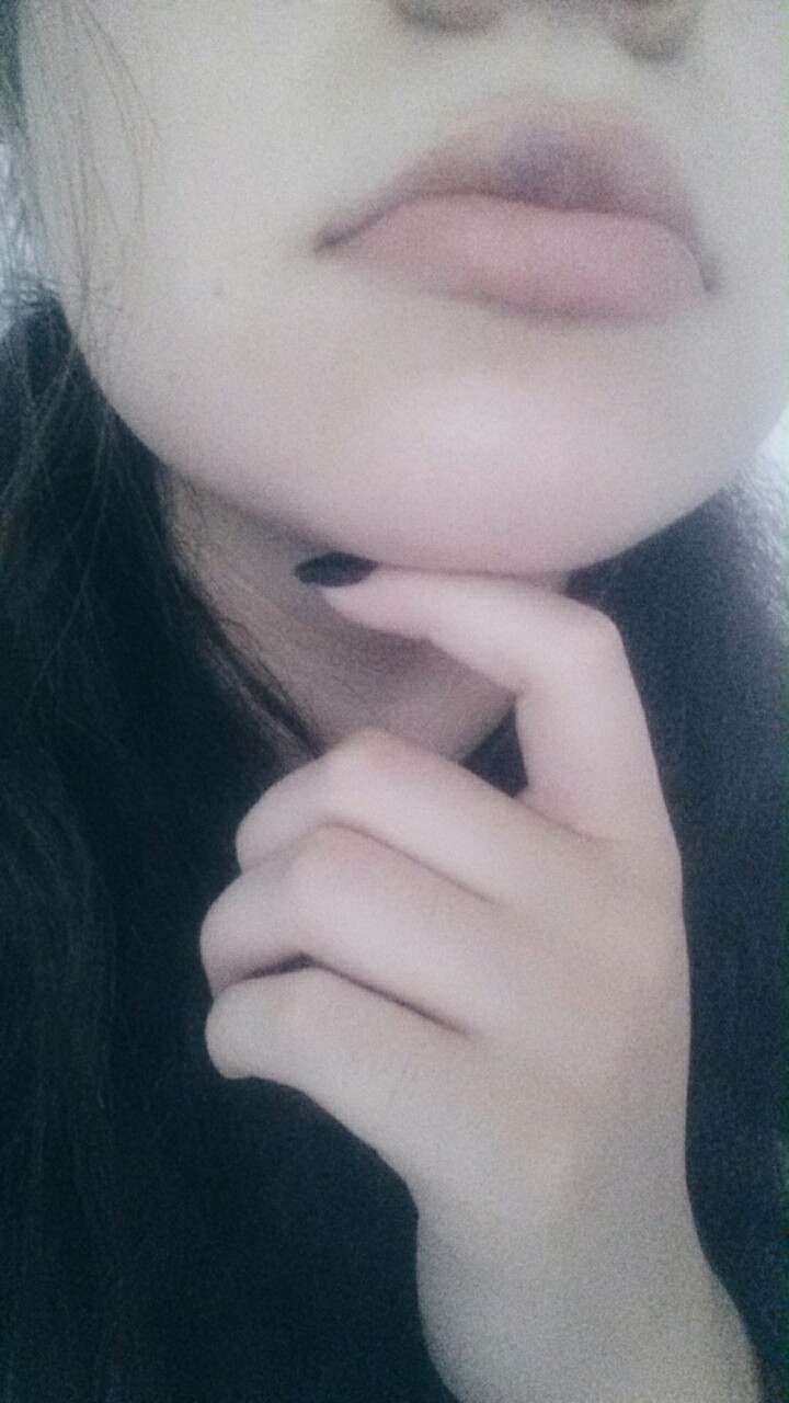 Hematoma.