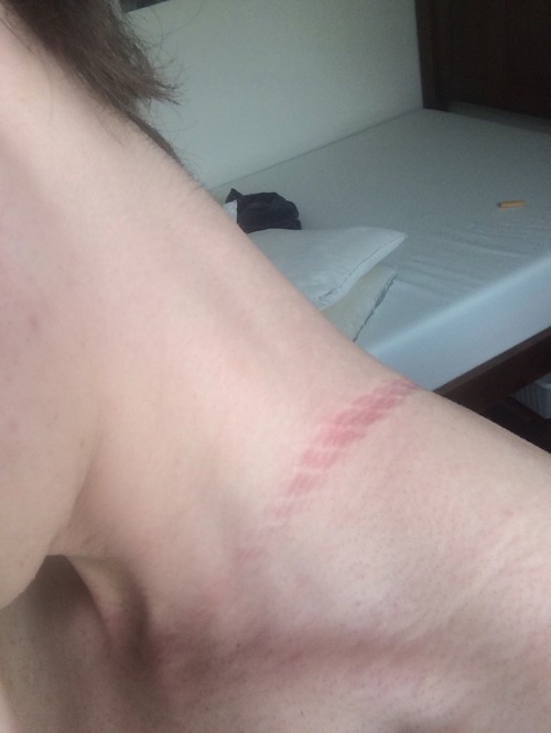 femme-prince-of-hell: bound and bruised. they/he