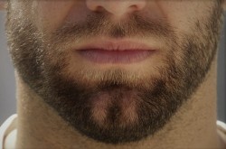 beardburnme2