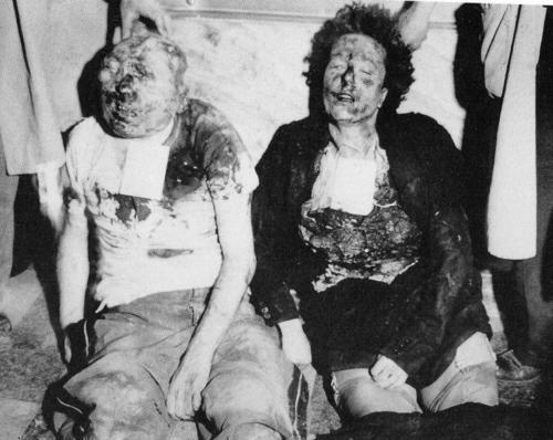 The corpse of Italian dictator Benito Mussolini and his mistress, April 25th, 1945, World War II.