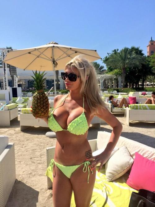 amateur-implant-pics:  DalzellSophie