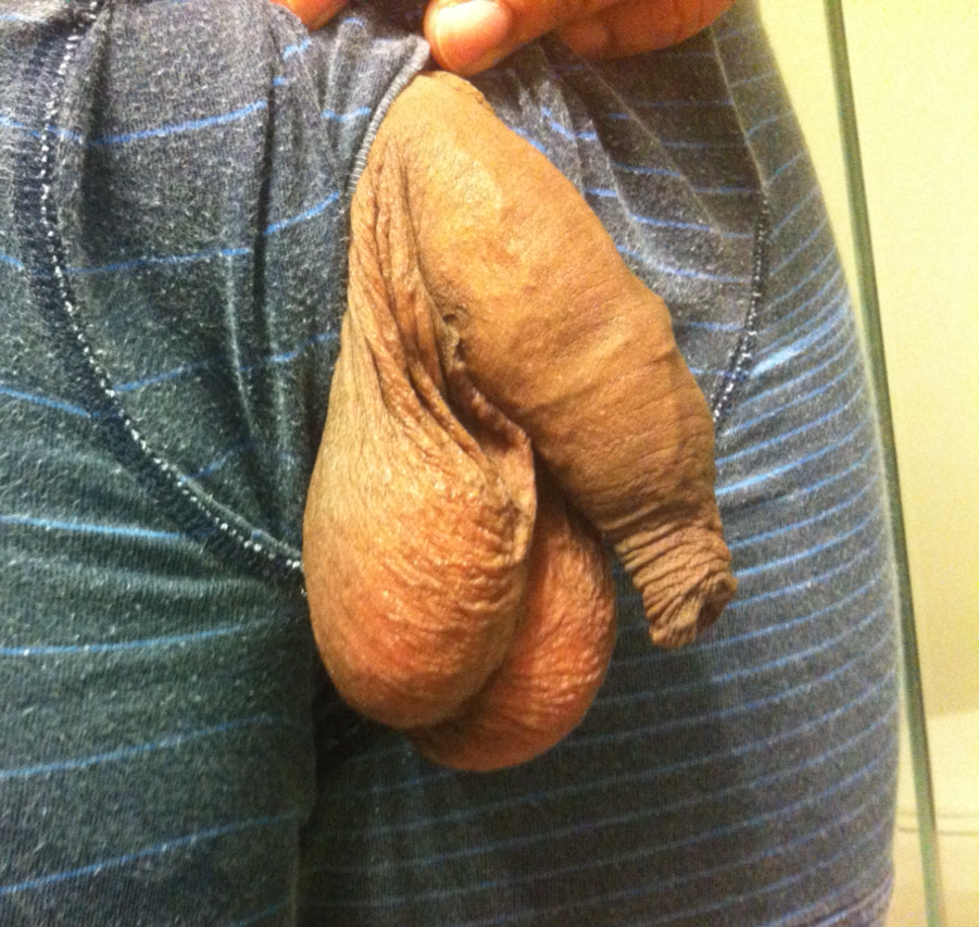 gotsomeballs:Balls that will drive you Nuts. 