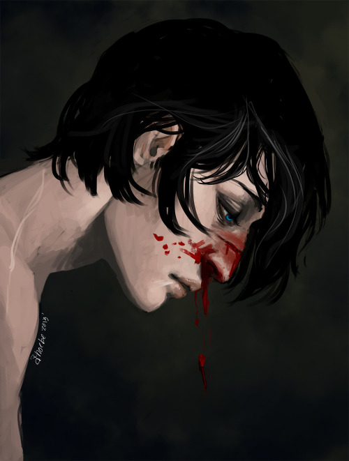 succulentthighs:  Sometimes Hawke trades in the blood stripe for an actual broken nose Like a real m