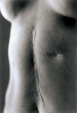salvatorearato:Miyako Ishiuchi 