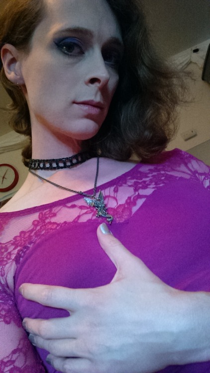 purplesonggirl:  Recovering from an injury, wanted to celebrate!