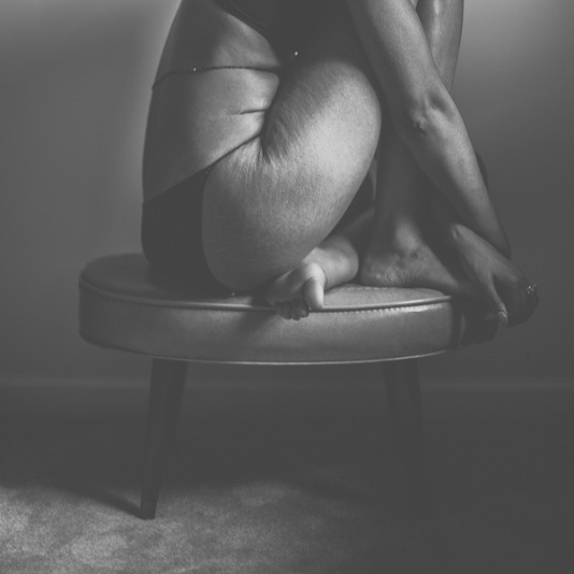 loveyourlines:  Imperfections are what makes us perfect. Easily said, harder to fully