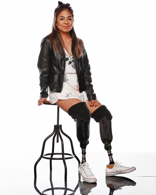 interdevo: dbk amputee woman with white converse sneakers on her prostheses So sweetie