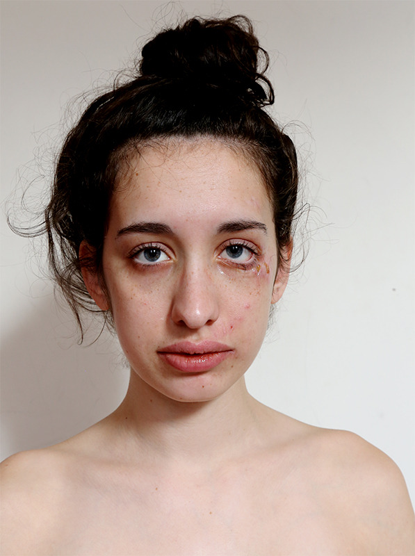 jemeos:  Jolie Savelle Kumin &lsquo;Healing&rsquo;, 2013.