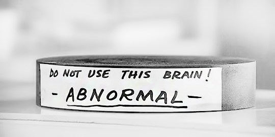dessinnoir:  “Abby… Normal. I’m almost sure that was the name.”Young Frankenstein