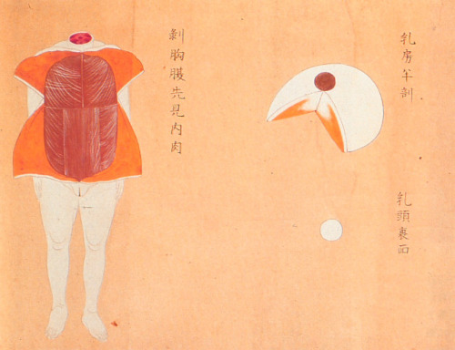 Female dissection. Edo-Period Japan.Conducted on the body of a 34-year-old female executed criminal.