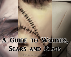 phoenixfire-thewizardgoddess:  darkwingsnark:  phenergan:  There is a serious lack of booboo tutorials.  I think it would also be important to note that surgeons also use steri-strips (butterfly stitches) as well. in fact, all my spinal operations had