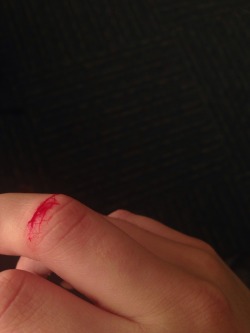 Accidentally cut my finger today