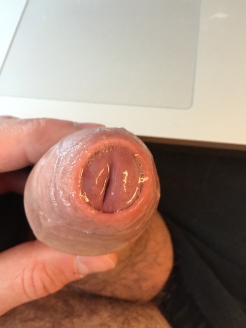 allforforeskin:  piggyunci“Your blog has porn pictures