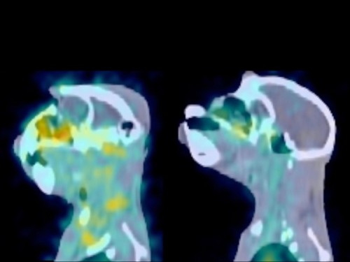 scienceyoucanlove:  A live look at the AIDS virusBy Jon Cohen 9 March 2015 Show me the monkey.Seeing is believing, and a study in rhesus macaques with a new imaging technique reveals for the first time a real-time map of an AIDS virus replicating in