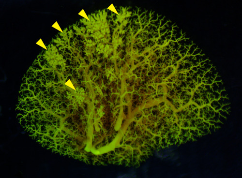 Excess Neuropeptides Disrupt Lung Function in Infant Disease and COVID-19 Excess fluid in the lung c