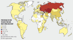 nprglobalhealth:  TB’s Revenge Tuberculosis