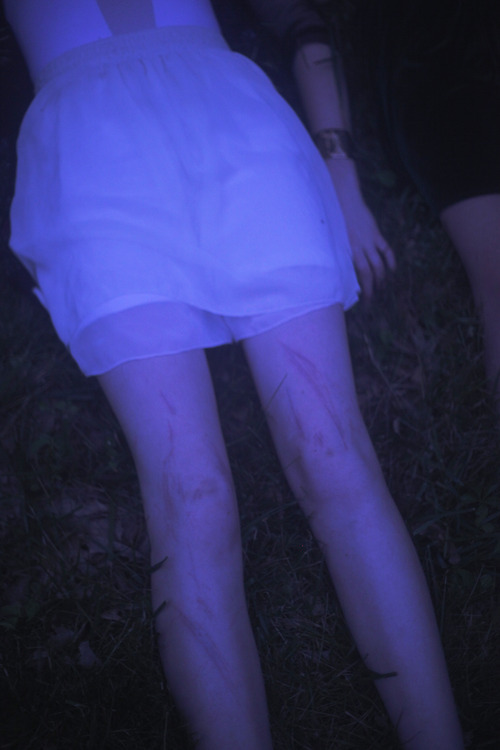 wretched-youth:   ☠ soft grunge ☠