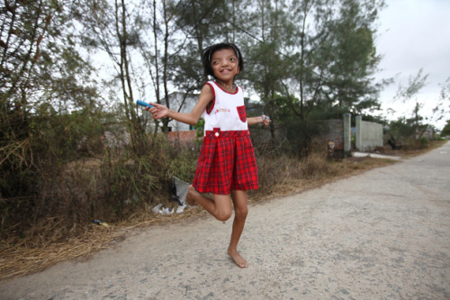 euthanizeallwhitepeople:  “Nguyen Thi Ly, 11, skips rope in her village south of Da Nang, Vietnam.  Her grandfather served in the North Vietnamese Army during the Vietnam War, and she is a third generation victim of dioxin exposure, the result of Agent