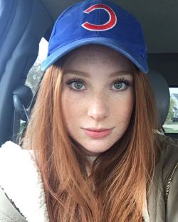 yesgingerfriend:  hellyeahredheads:cubs Tolle Sommersprossen