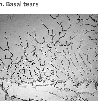 womaninterrupted:policymic:Stunning photos of tears under a microscope vary by emotionFollow policym