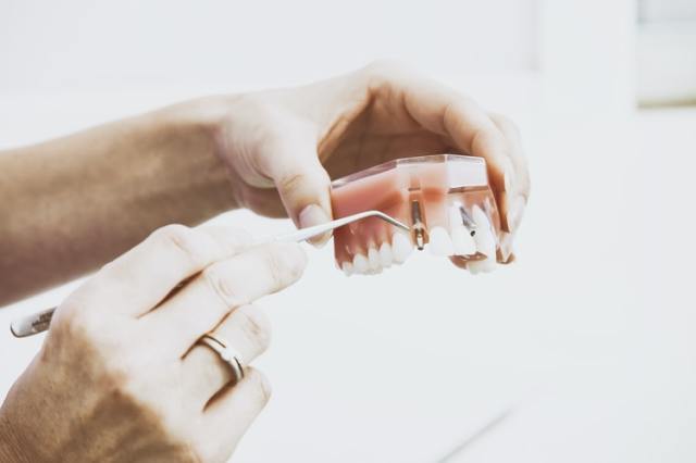 dental implants melbourne