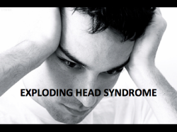 sixpenceee:  Exploding syndrome isn’t what the name sounds like, as defined by the American Sleep Association:  Exploding head syndrome is a rare and relatively undocumented parasomnia event in which the subject experiences a loud bang in their head