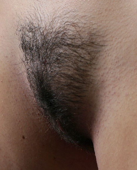 hairy-teeners:  Sally 18yo 
