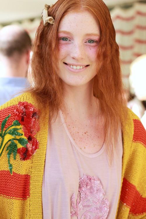 I Love Lots of FRECKLES!